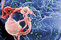 http://upload.wikimedia.org/wikipedia/commons/thumb/1/1a/HIV-budding-Color.jpg/190px-HIV-budding-Color.jpg